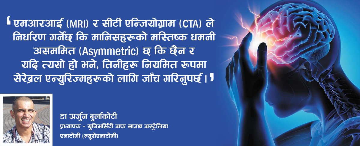 मस्तिष्क एन्युरिज्मको जोखिम बारे विश्वभर चर्चा पाएको अस्ट्रेलियाका नेपाली डाक्टरको अनुशन्धान के हो ?