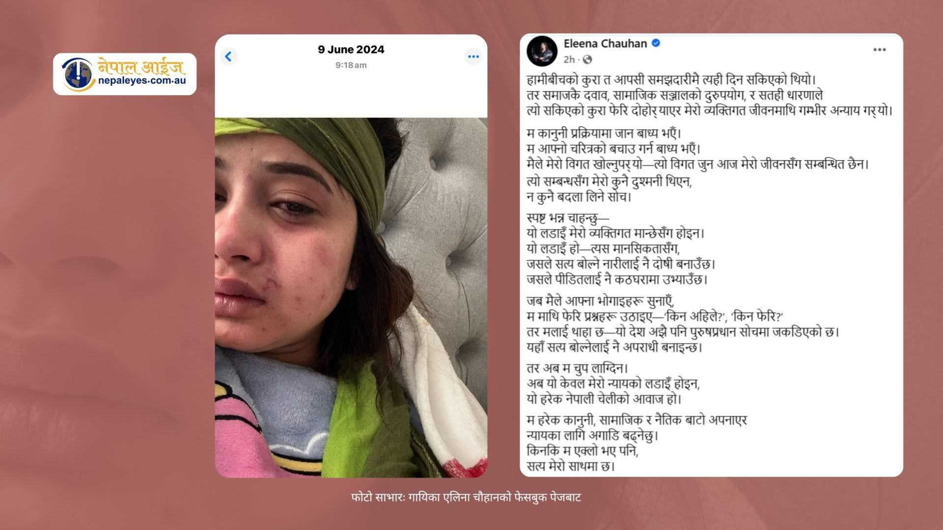 आफूले शारीरिक तथा मानसिक हिंसा भोगेको भन्दै गायिका चौहान भन्छिन अब म चुप लाग्दिन